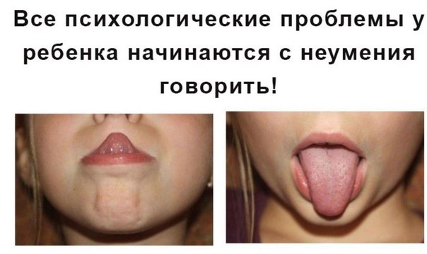 Избавьте детей от стресса! Это очень важно для них! 