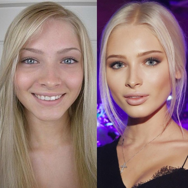 Алена Шишкова раньше и сейчас.