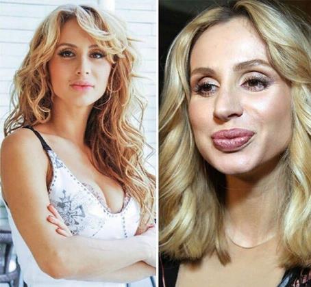 Светлана Лобода раньше и сейчас.