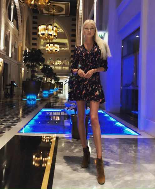 А вам не кажется, что у Алены Шишковой анорексичные ноги