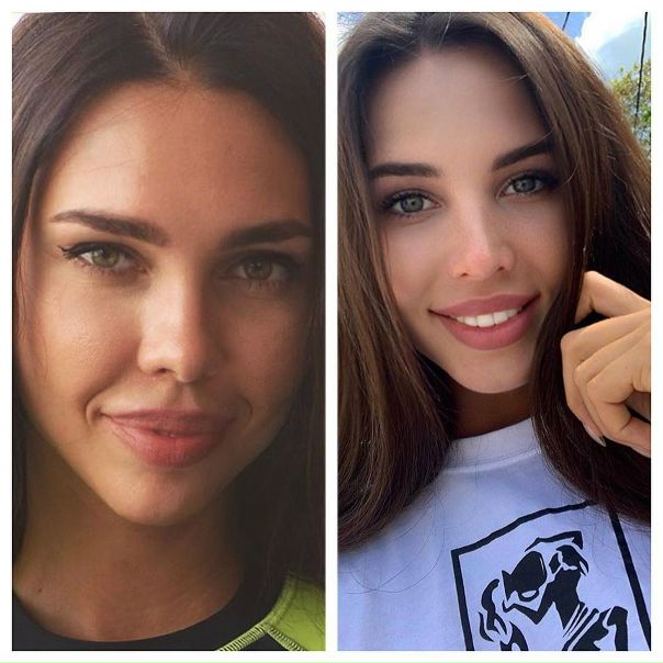 Один и тот же хирург