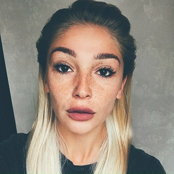 А вам нравятся веснушки Насти Ивлеевой