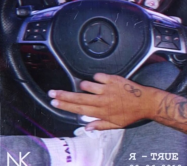 Настя Кудри показала руку после ампутации пальцев.