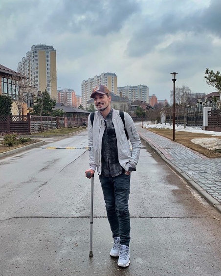 Дима Билан до сих пор ходит с тросточкой.