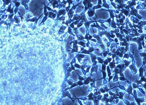Иранские ученые разработали способ активации иммунных клеток